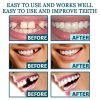 Adjustable Snap-On Dentures Adjustable Snap-On Dentures