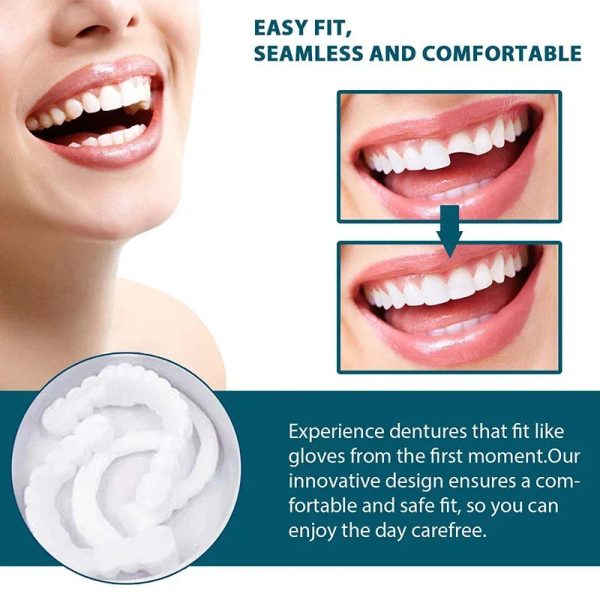 Adjustable Snap-On Dentures Adjustable Snap-On Dentures