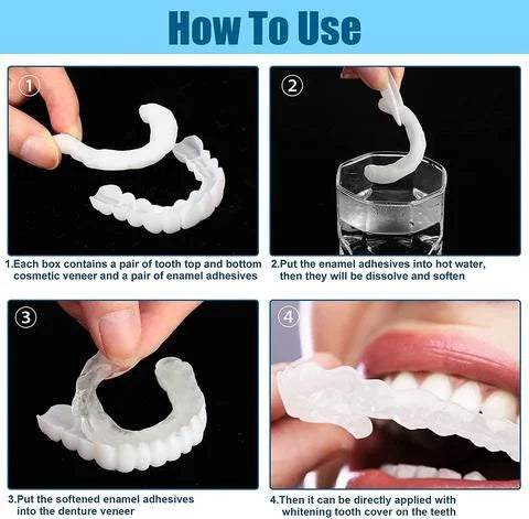 Adjustable Snap-On Dentures Adjustable Snap-On Dentures
