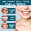 Adjustable Snap-On Dentures Adjustable Snap-On Dentures