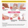Dead Skin Remover Crack Cream Dead Skin Remover Crack Cream