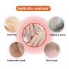 Dead Skin Remover Crack Cream Dead Skin Remover Crack Cream