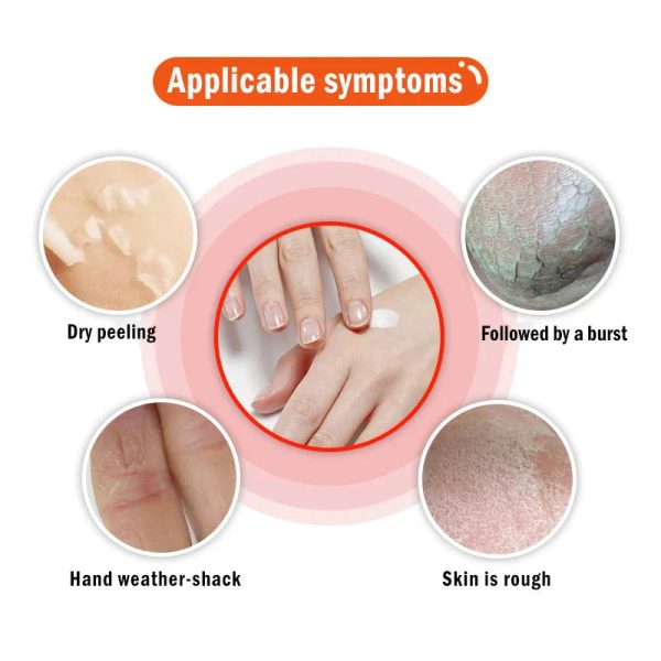 Dead Skin Remover Crack Cream Dead Skin Remover Crack Cream