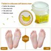 Dead Skin Remover Crack Cream Dead Skin Remover Crack Cream