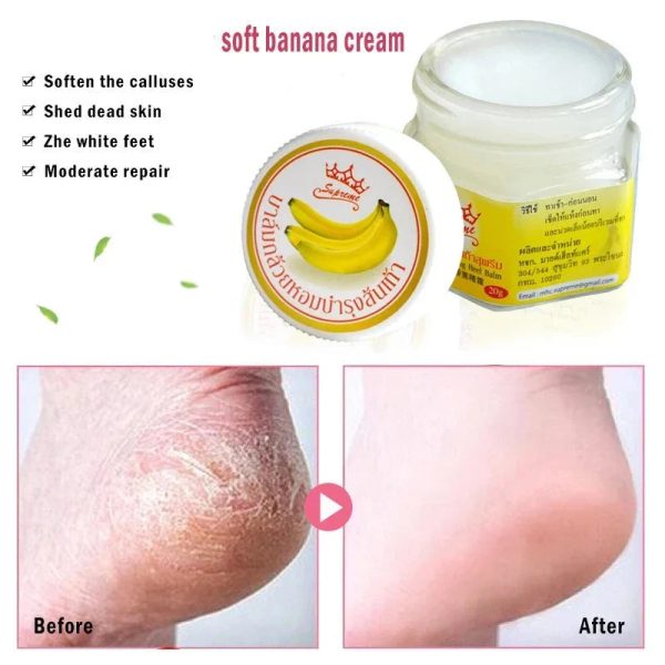 Dead Skin Remover Crack Cream Dead Skin Remover Crack Cream