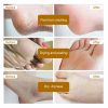 Dead Skin Remover Crack Cream Dead Skin Remover Crack Cream