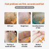 Dead Skin Remover Crack Cream Dead Skin Remover Crack Cream
