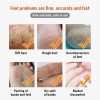 Dead Skin Remover Crack Cream Dead Skin Remover Crack Cream