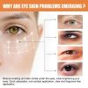 Eelhoe Vitamin C Eye Cream Stick Moisturizing & Brightening For Dark Circles, Puffiness, & Fine Lines
