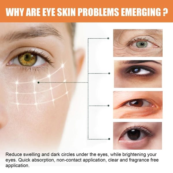 Eelhoe Vitamin C Eye Cream Stick Moisturizing & Brightening For Dark Circles, Puffiness, & Fine Lines