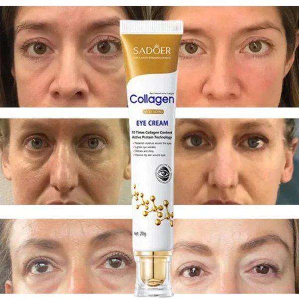 Instant Eye Bag Removal