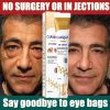 Instant Eye Bag Removal