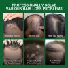 Rosemary Hair Growth Essential Oil